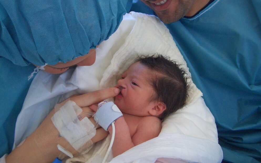 Padres y personal médico brindando apoyo integral a un recién nacido con fisura labiopalatina