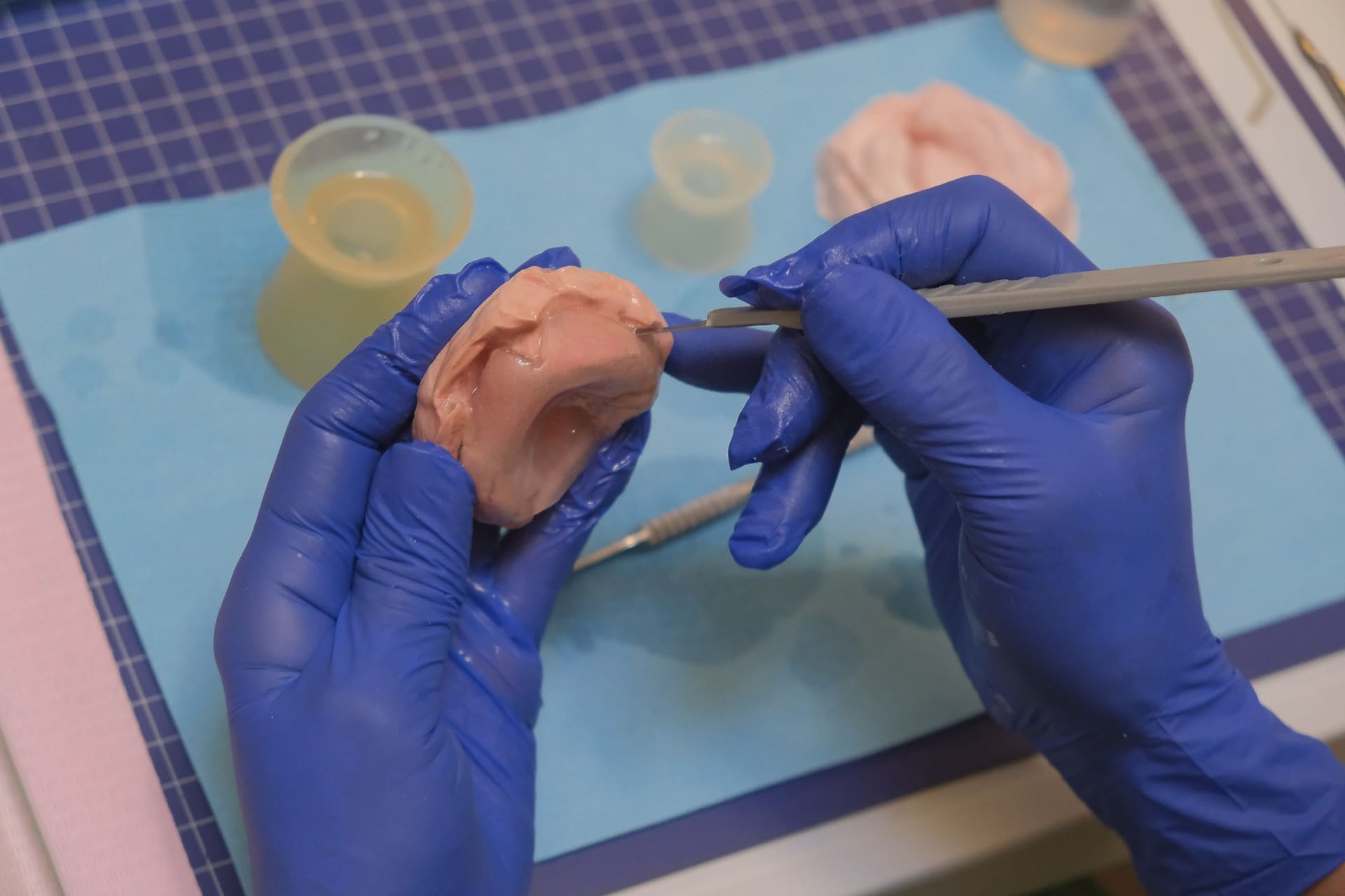 Proceso de confección de una placa ortopédica funcional para pacientes con fisura labiopalatina en laboratorio dental